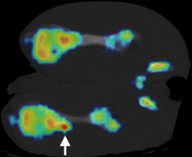 Figure 5a: