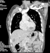 Figure 2c
