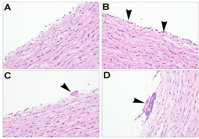 Fig. 5 -