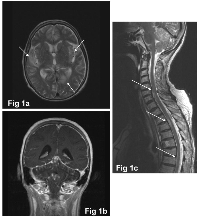 Fig 1