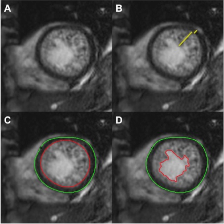 Fig. 2