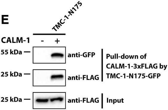 Figure 2E