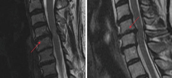 Figure 11.