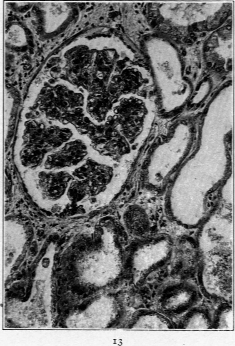 Fig. 13