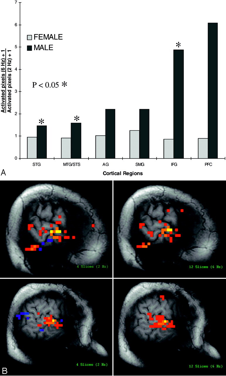 Fig 3.