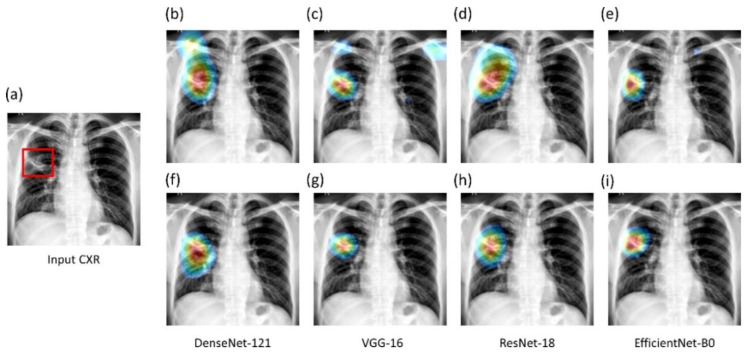 Figure 12