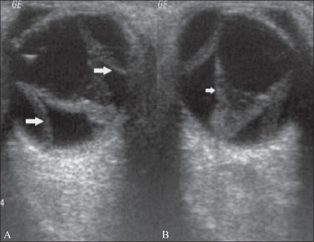 Figure 7 (A,B)