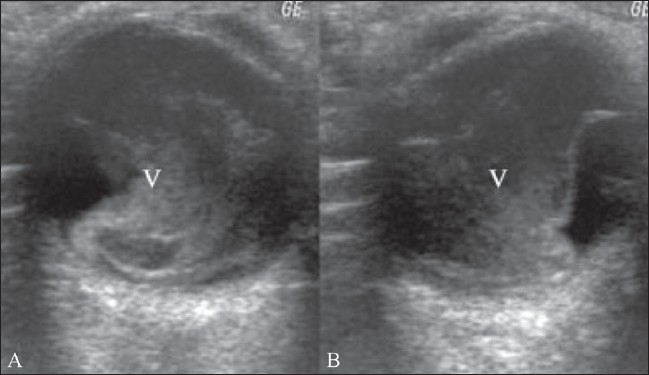 Figure 18 (A,B)