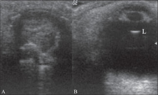 Figure 16 (A,B)