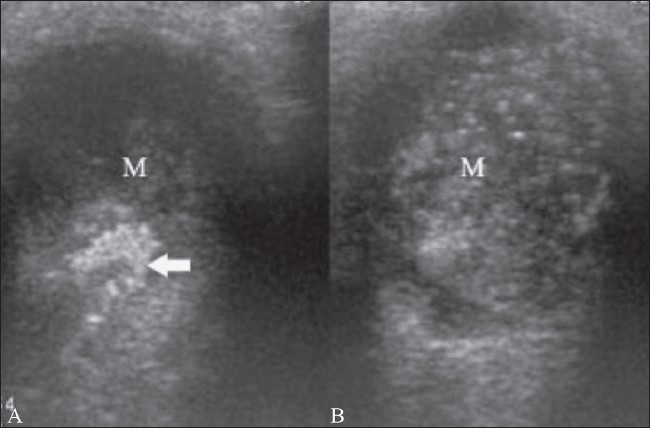 Figure 15 (A,B)