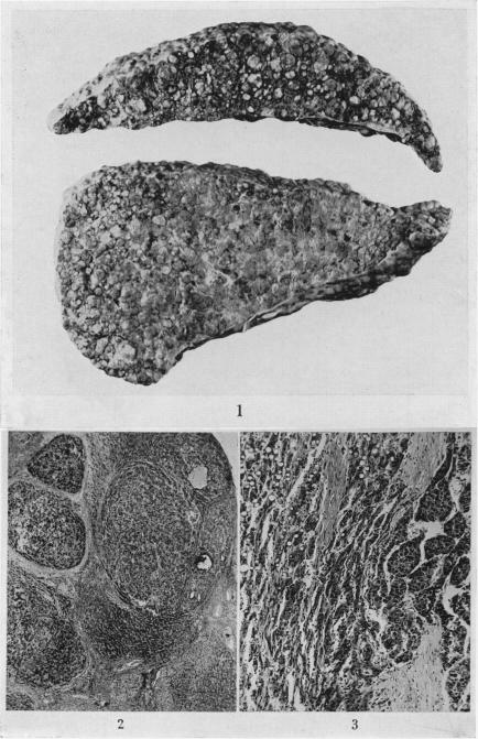 Figs. 1-3