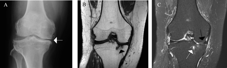 Fig. 1