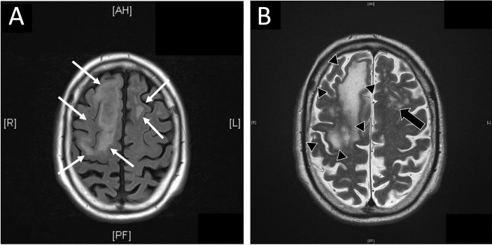 Figure 1