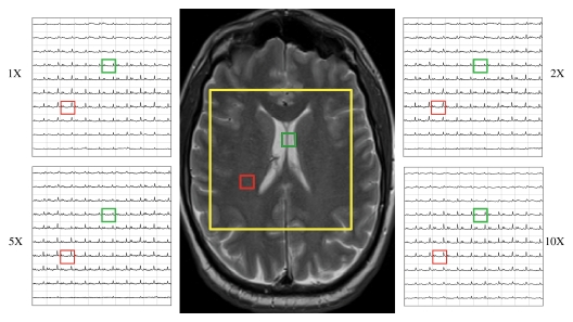 Figure 1: