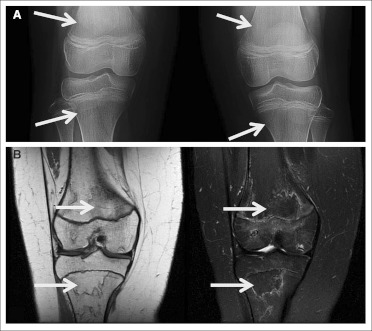 Fig 3.