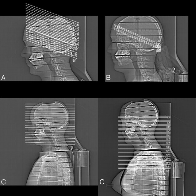 Fig 1.