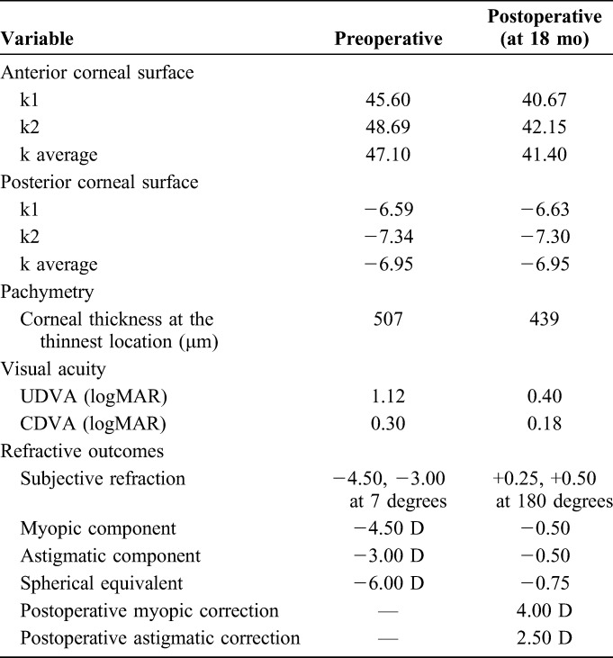 graphic file with name cornea-37-1143-g003.jpg