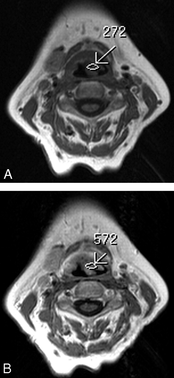 Fig 3.