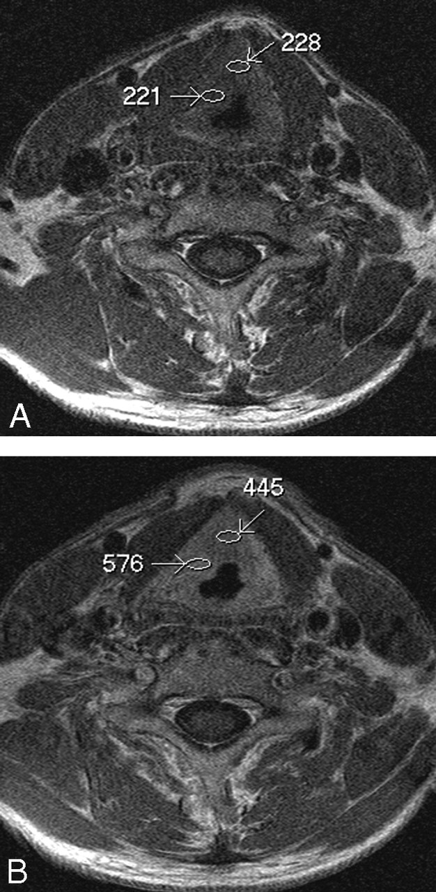 Fig 5.