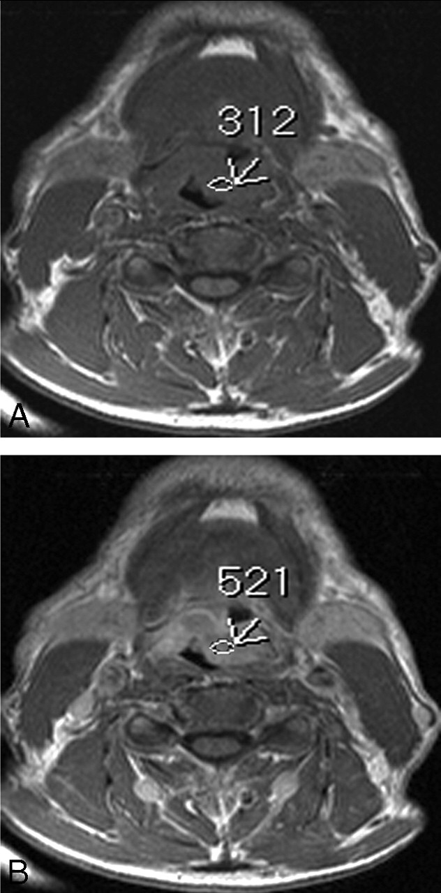 Fig 2.