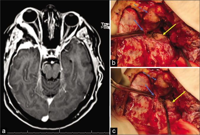 Figure 1: