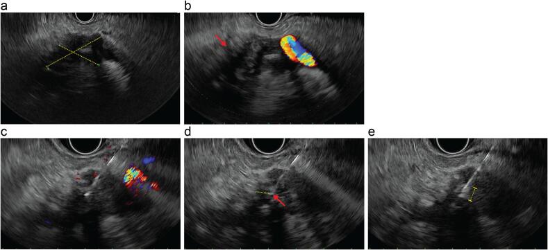 Fig. 2