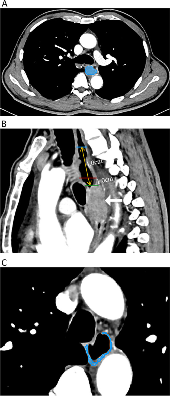 Fig. 2