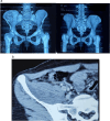 Fig. 1a