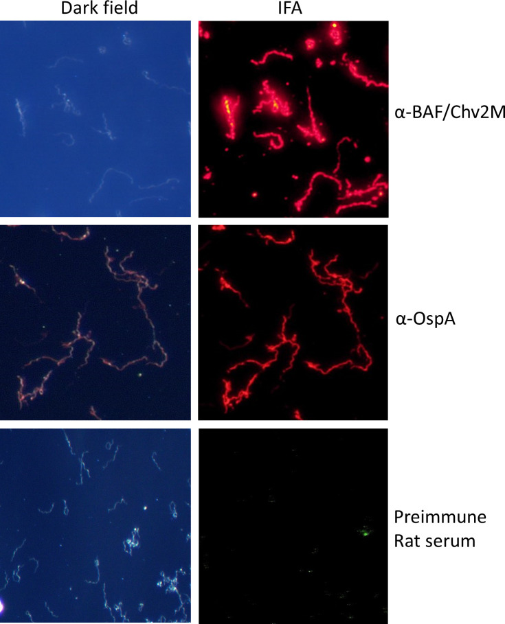 Darkfield and IFA microscopy images of bacterial samples treated with different antibodies (α-BAF/Chv2M, α-OspA) and preimmune rat serum. Bright fluorescence indicates specific antibody binding in the IFA images.