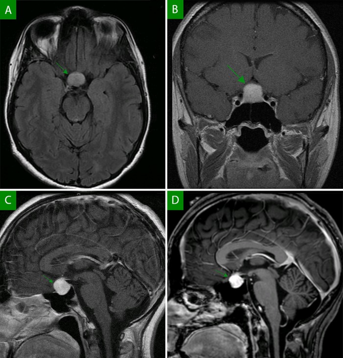 Figure 1