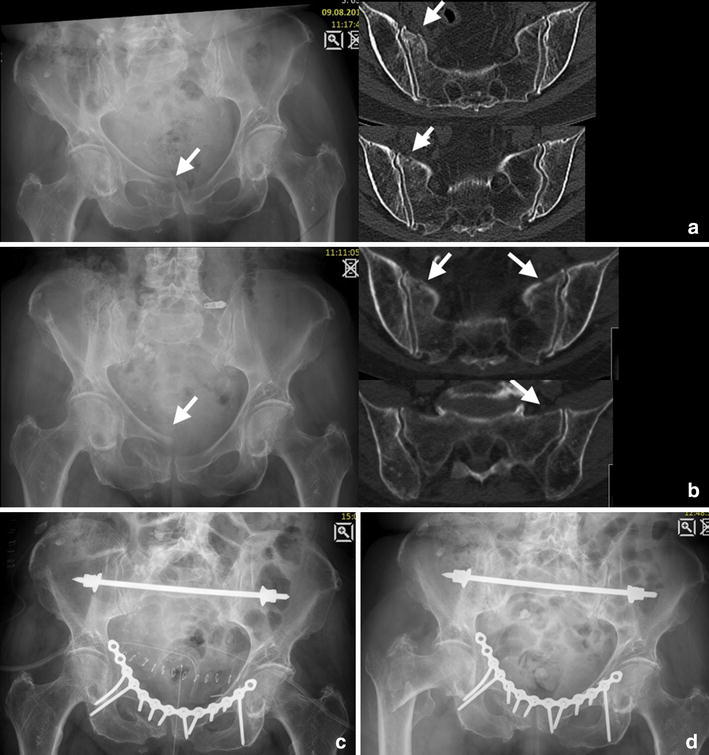 Fig. 5