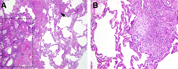 Figure 1