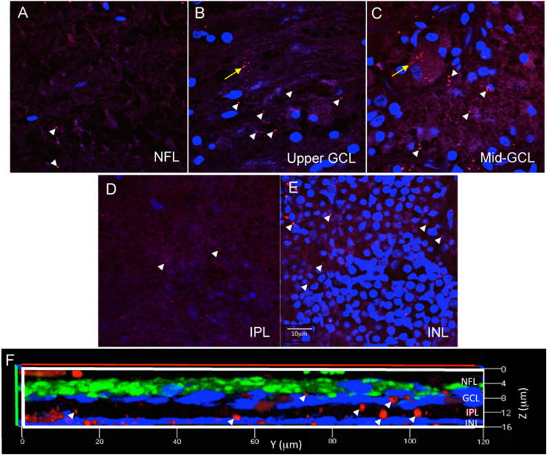 FIGURE 3