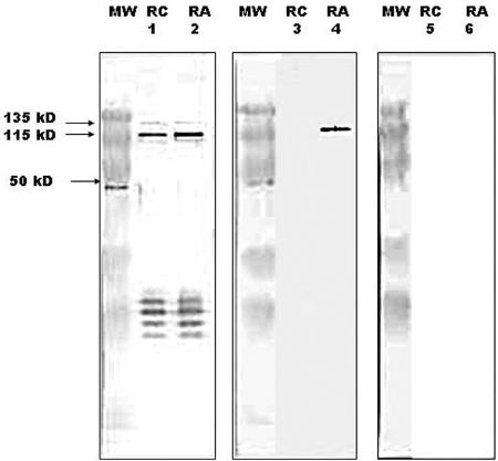 FIG. 11.