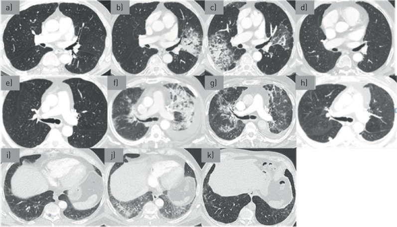 FIGURE 1