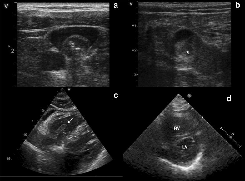 Fig. 1