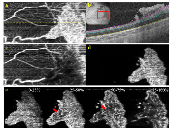 Fig. 12