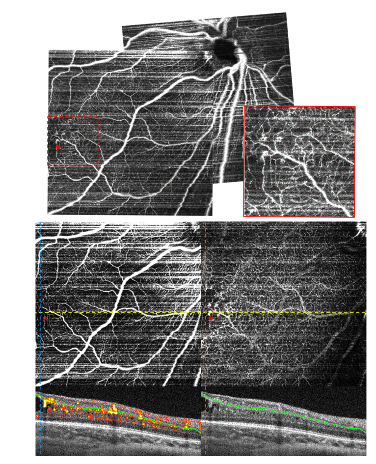 Fig. 11