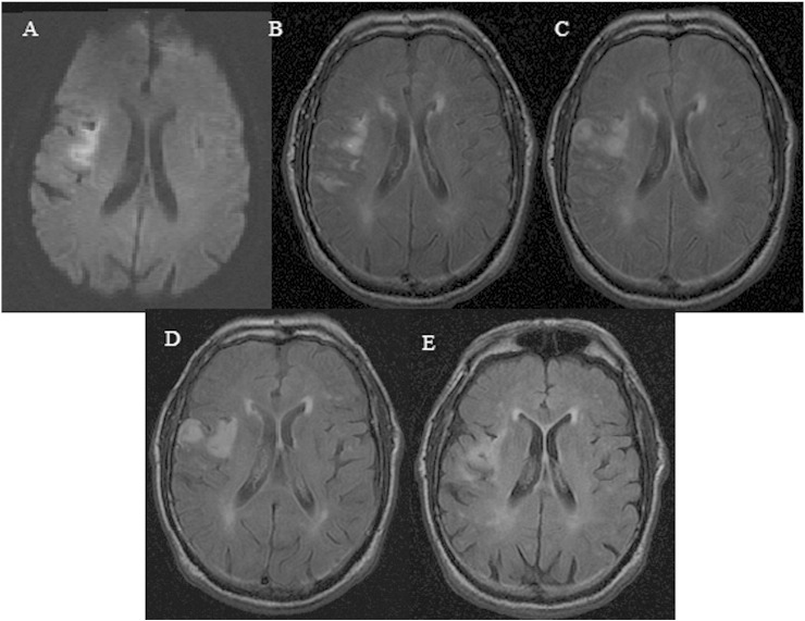 Fig. 1