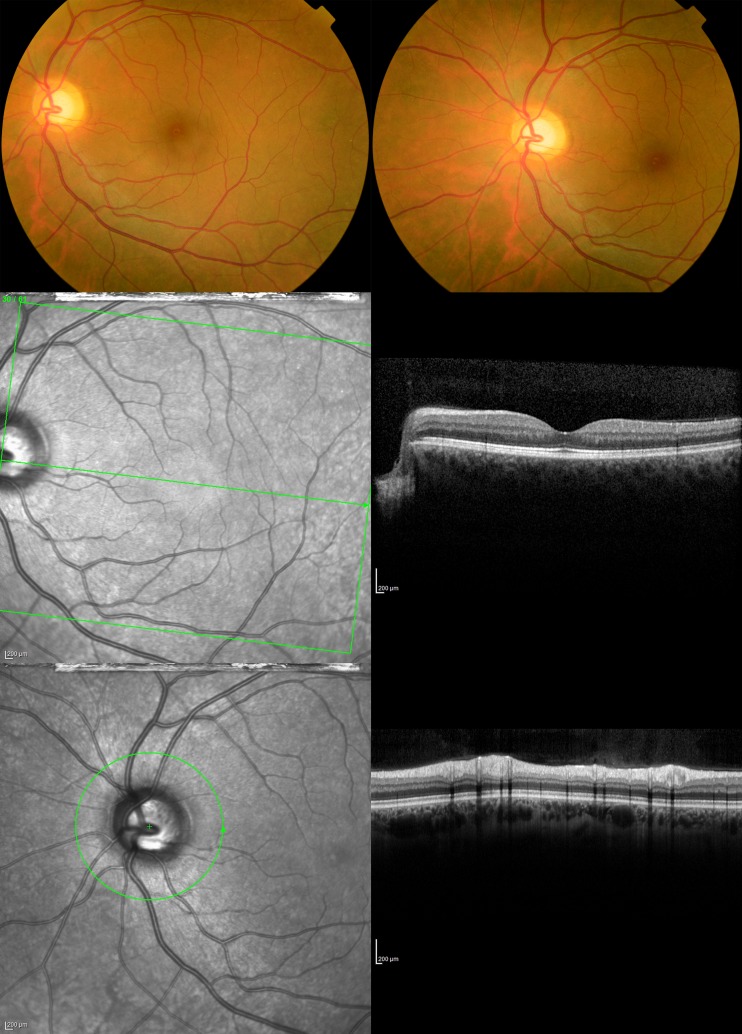 Fig 1