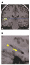 FIG. 6