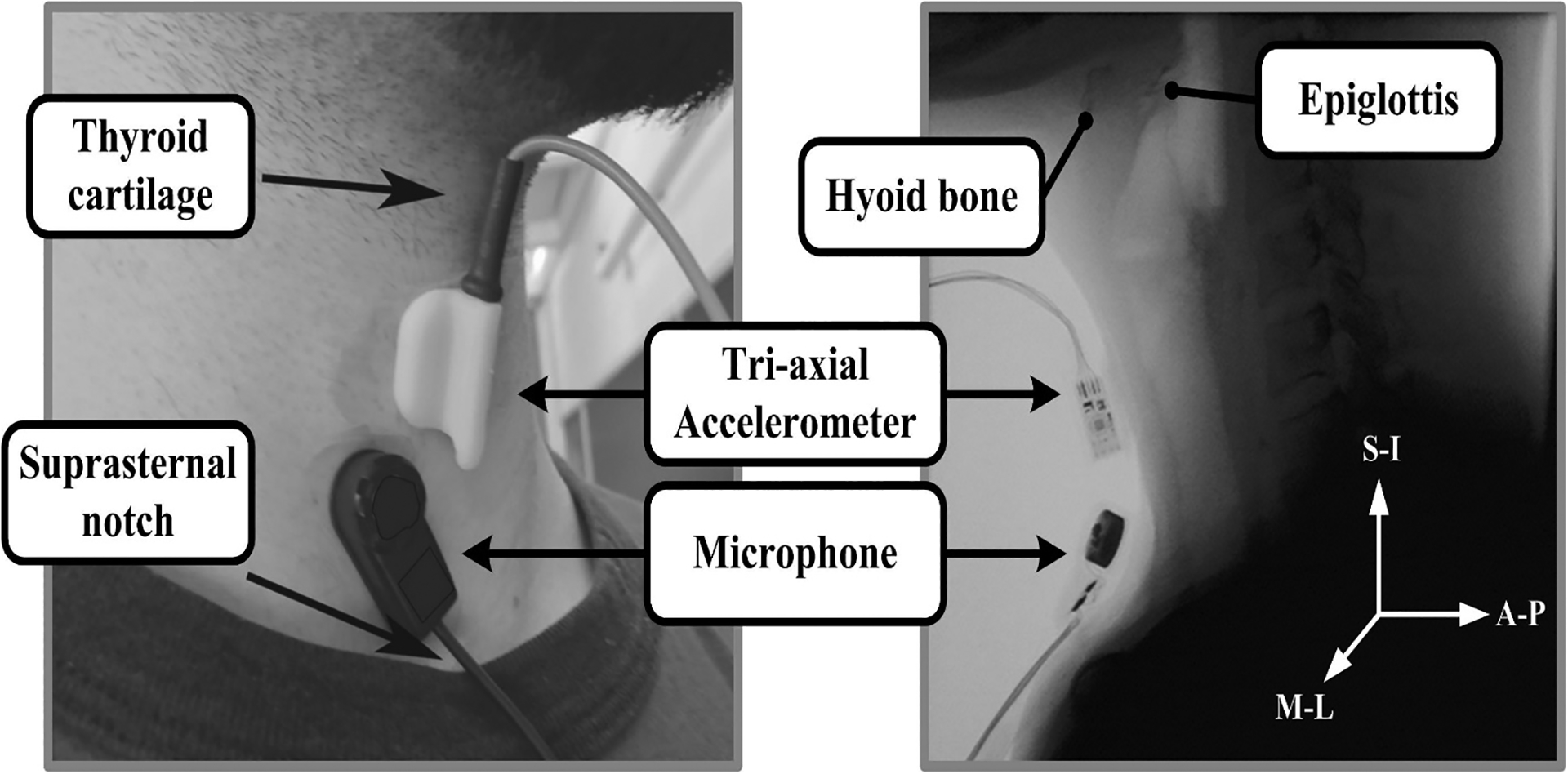 Figure 1: