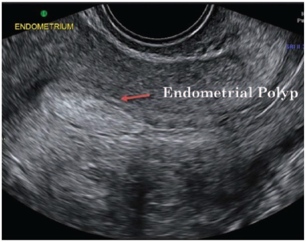 Figure 6.