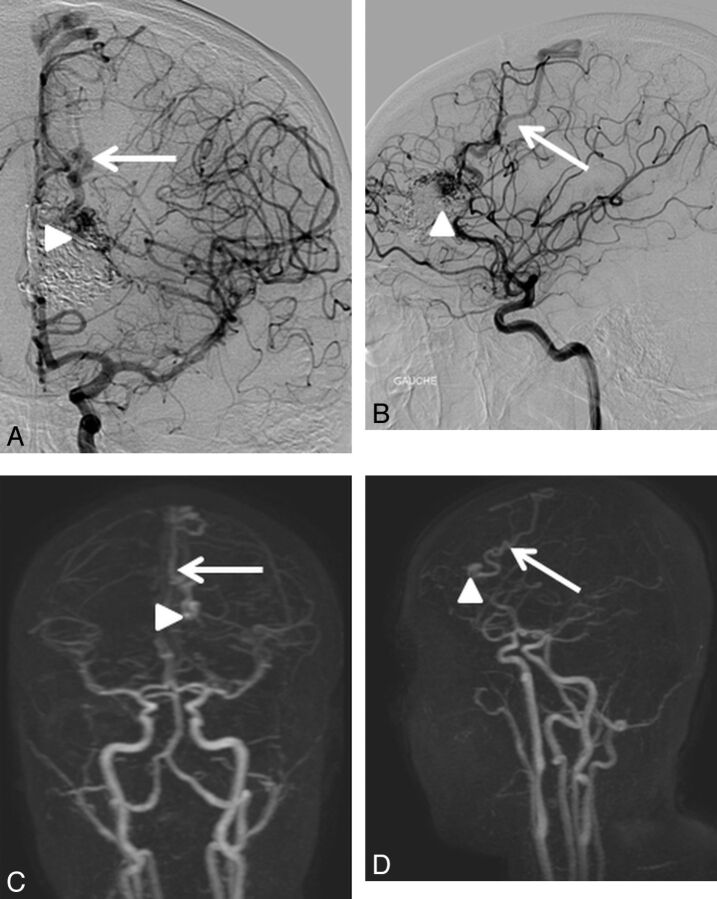 Fig 4.