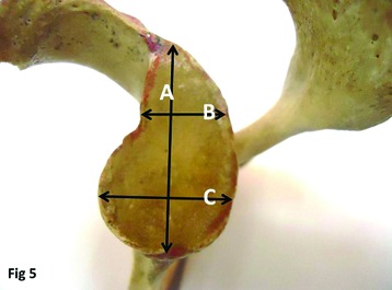 [Table/Fig-5]: