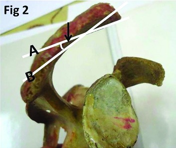 [Table/Fig-2]: