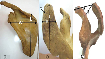 [Table/Fig-4a-c]: