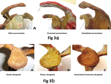 [Table/Fig-3a,b]: