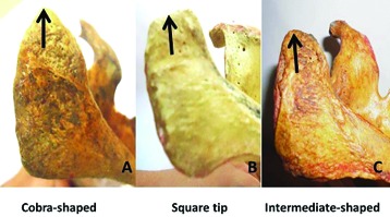 [Table/Fig-1]: