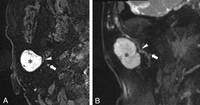 Fig 2.